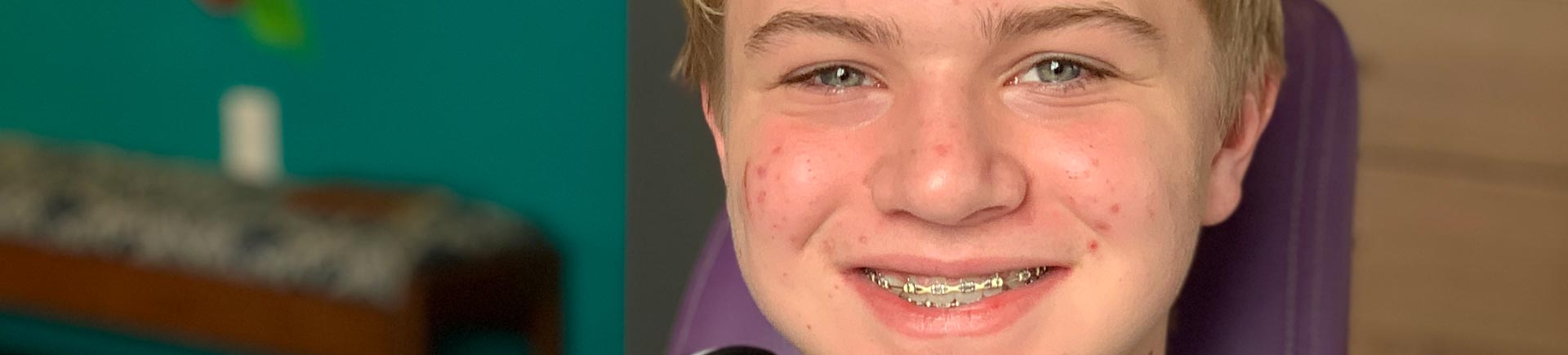 teenager with orthodontic braces