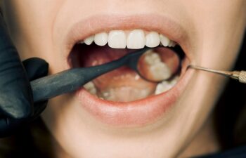 orthodontist in San Antonio, TX, inspects female patient's teeth with diagnostic tools